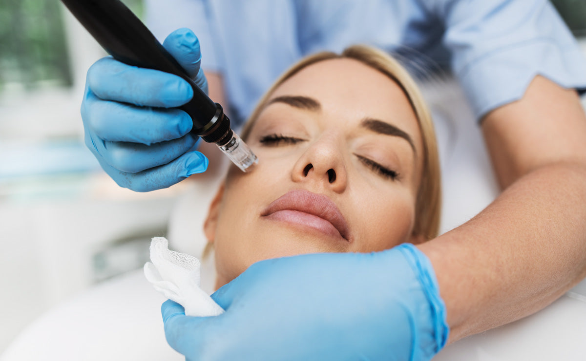 woman receiving Micro needling + RescueMD skin treatment for hyperpigmentation on treatment bed