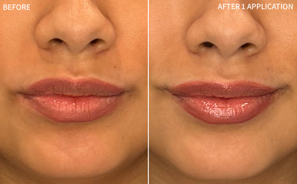 Dry Lips | 1 Application