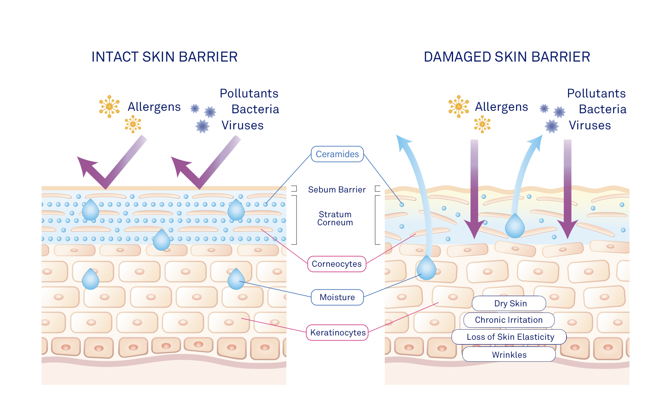 label diagram comparing intact and damaged skin barriers. One side shows intact skin barrier with well-organized skin layers, while the other side shows damaged skin barrier with gaps and disrupted skin layers