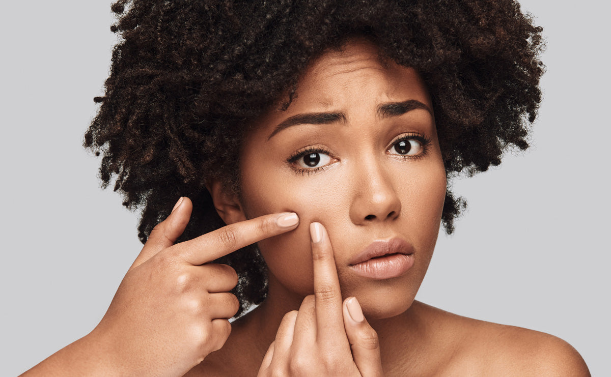 a woman standing in front of a mirror, pointing at her cheeks with both hands and looking tense, as she notices acne scars on her face, her expression reflects concern and distress about  her skin