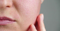 The Science Behind Lapachol: How RescueMD's DNA Repair Complex Works at the Deepest Level of Your Skin