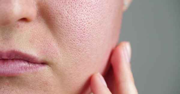The Science Behind Lapachol: How RescueMD's DNA Repair Complex Works at the Deepest Level of Your Skin
