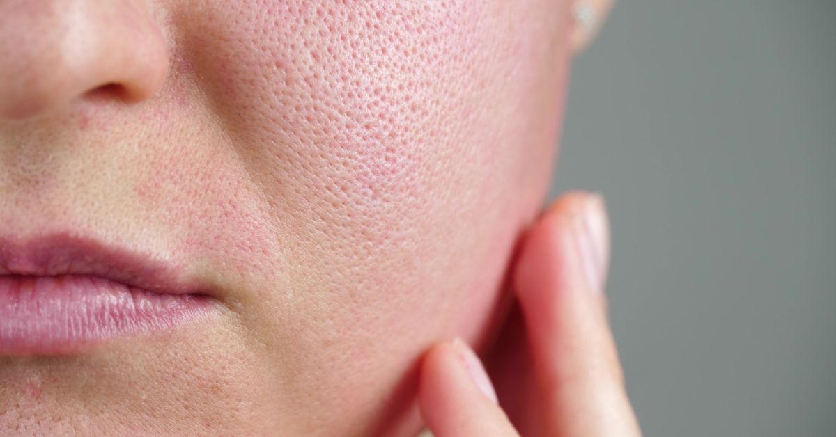 The Science Behind Lapachol: How RescueMD's DNA Repair Complex Works at the Deepest Level of Your Skin
