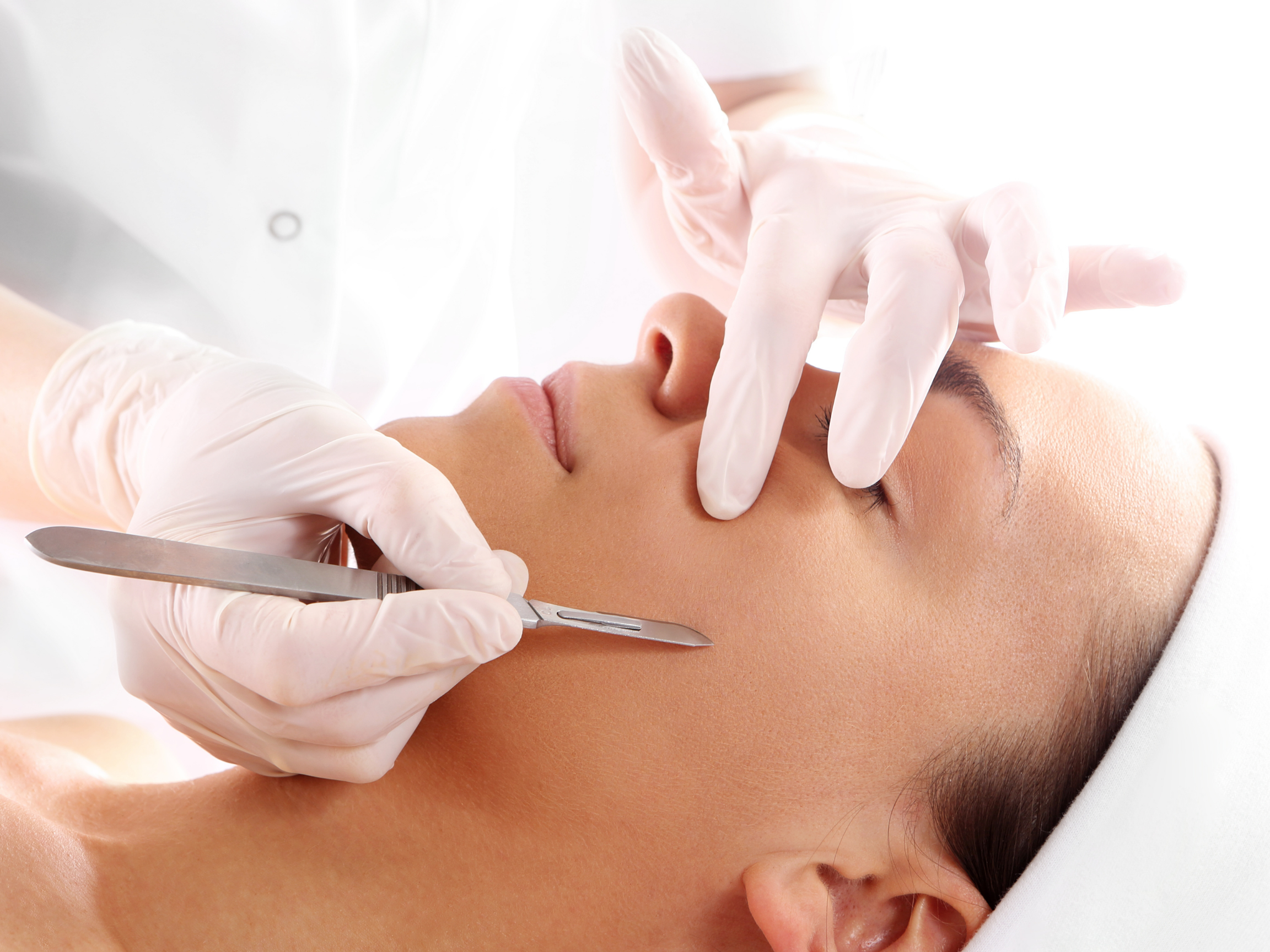 woman with closed eyes on treatment bed receiving a dermaplaning treatment