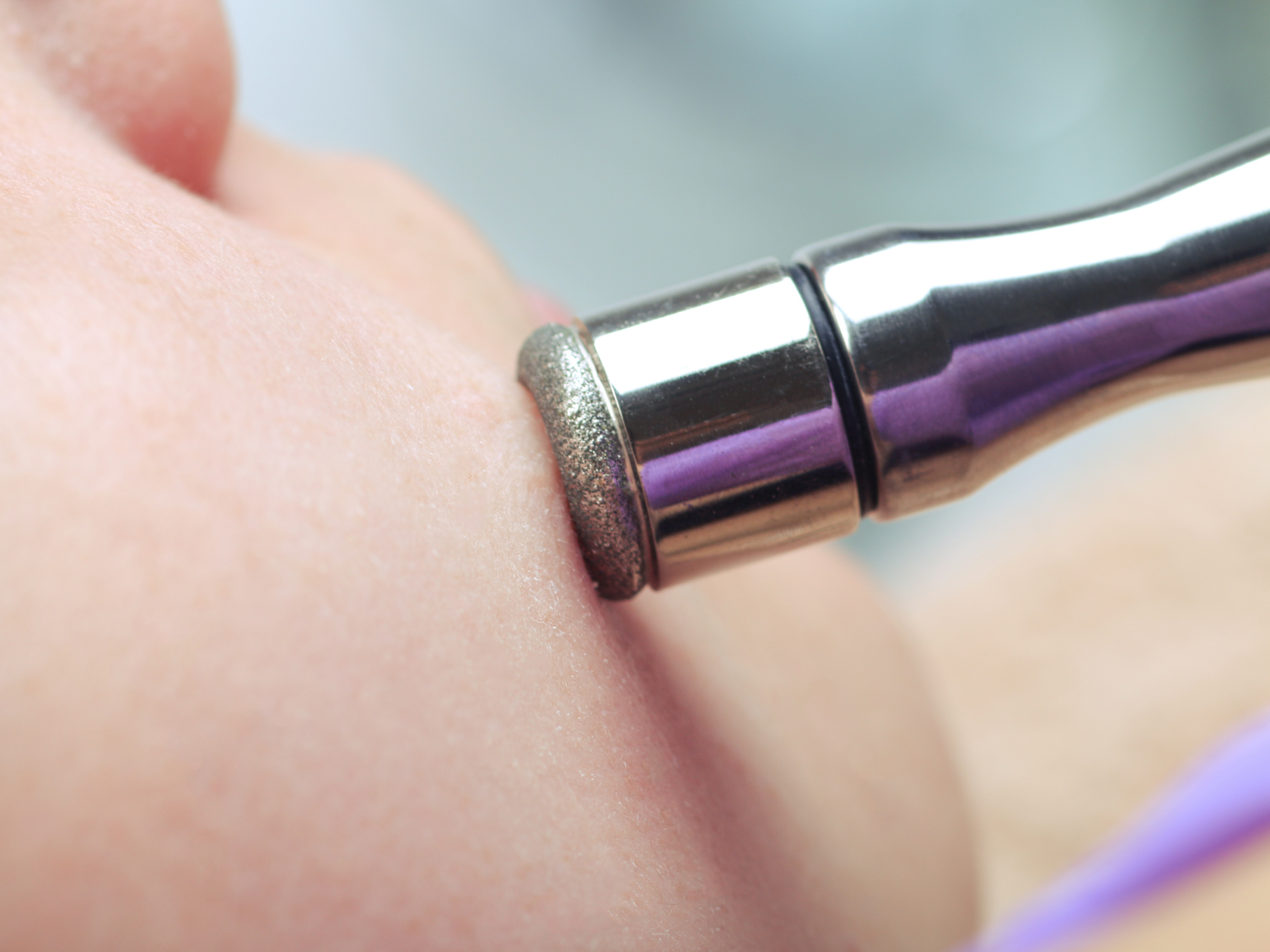 a close-up shot of a woman receiving microdermabrasion treatment, showing the treatment device being applied to her skin